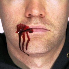 SAFEX Blood fluid for effects in the mouth area
